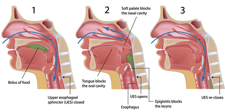 swallow-dysfunction-and-choking-huntington-s-disease-society-of-america